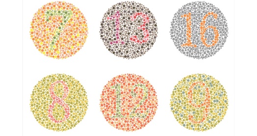 Colour Vision Assessment