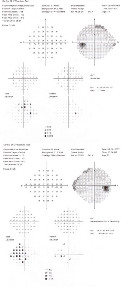 Visual Fields (Section 1)